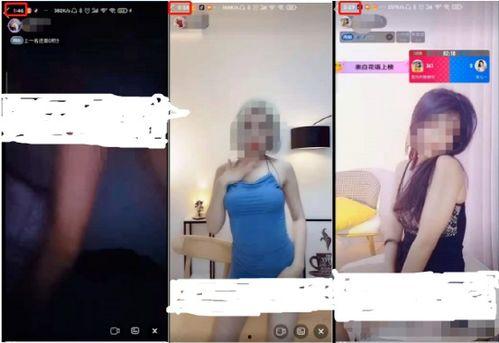 成人硬肿症有关视频,病因、症状及防治策略