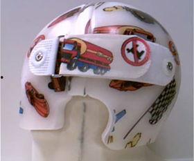 成人头盔矫正视频大全,成人头盔矫正视频大全精华汇总